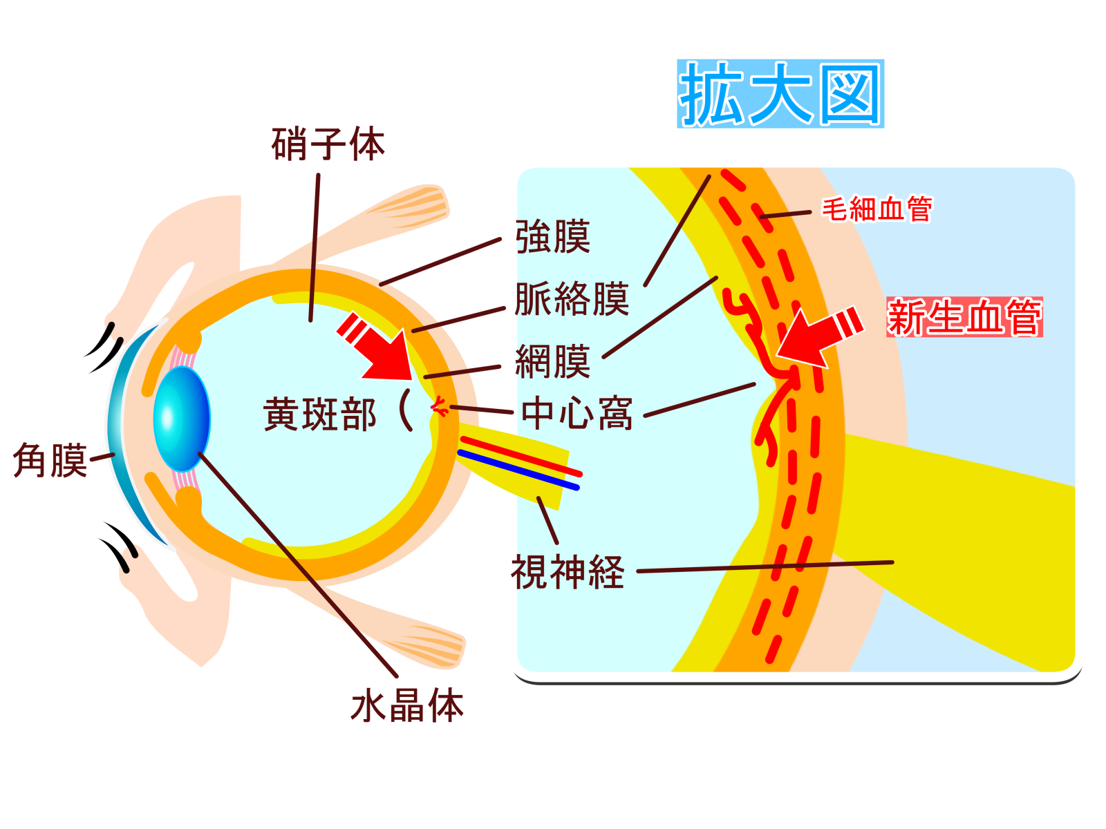 黄斑